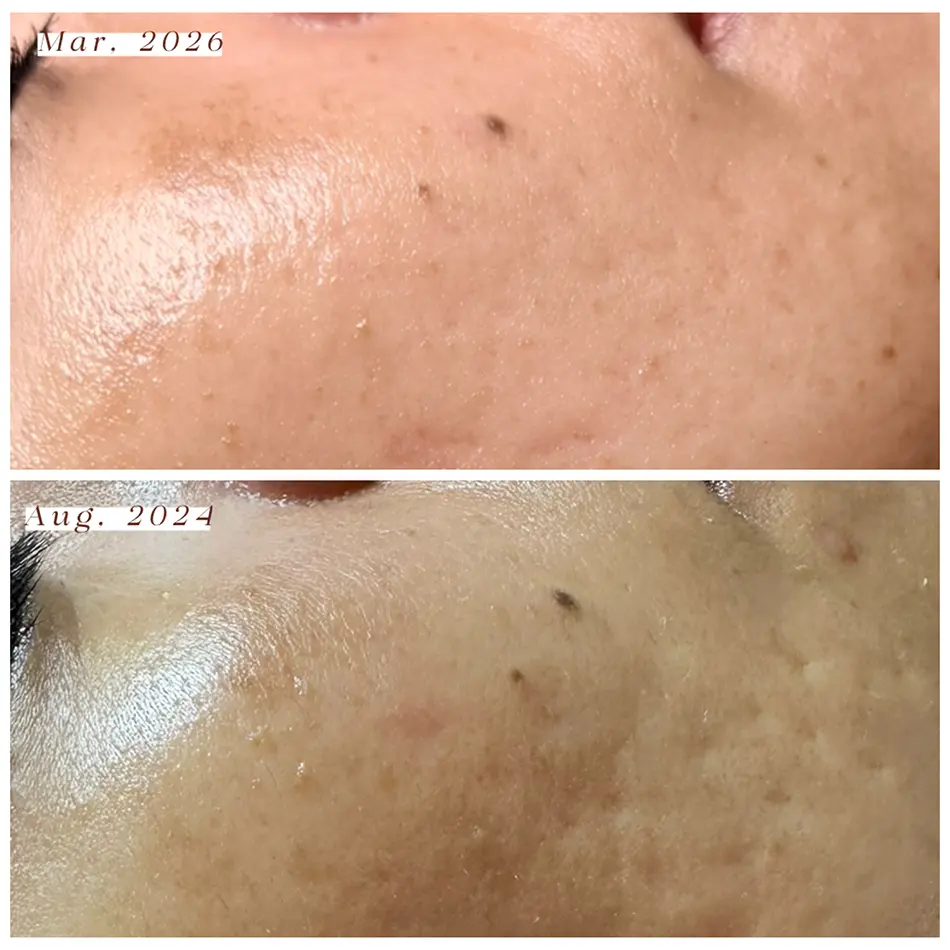 A fully customized luxury facial in San Antonio designed to deliver visible results while allowing you to completely unwind